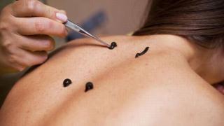 ВРАЧ - ГИРУДОТЕРАПЕВТ, СЕМЕЙНЫЙ ДОКТОР, ВРАЧ ОБЩЕЙ ПРАКТИКИ Фото 3