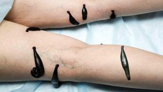 ВРАЧ - ГИРУДОТЕРАПЕВТ, СЕМЕЙНЫЙ ДОКТОР, ВРАЧ ОБЩЕЙ ПРАКТИКИ Фото 2