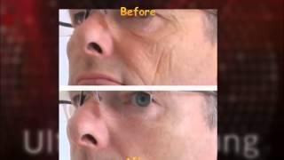 Лифтинг-крем Ultimate Young BeautyLine Фото 3