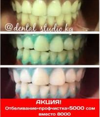 "Dental Studio" Все виды стоматологических услуг ! Фото 3