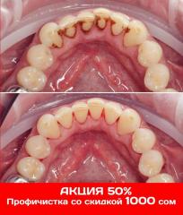 "Dental Studio" Все виды стоматологических услуг ! Фото 4