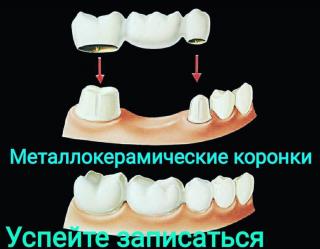 Все виды стоматологических услуг. Суйундуков Жоомарт Эсенбек Фото 2